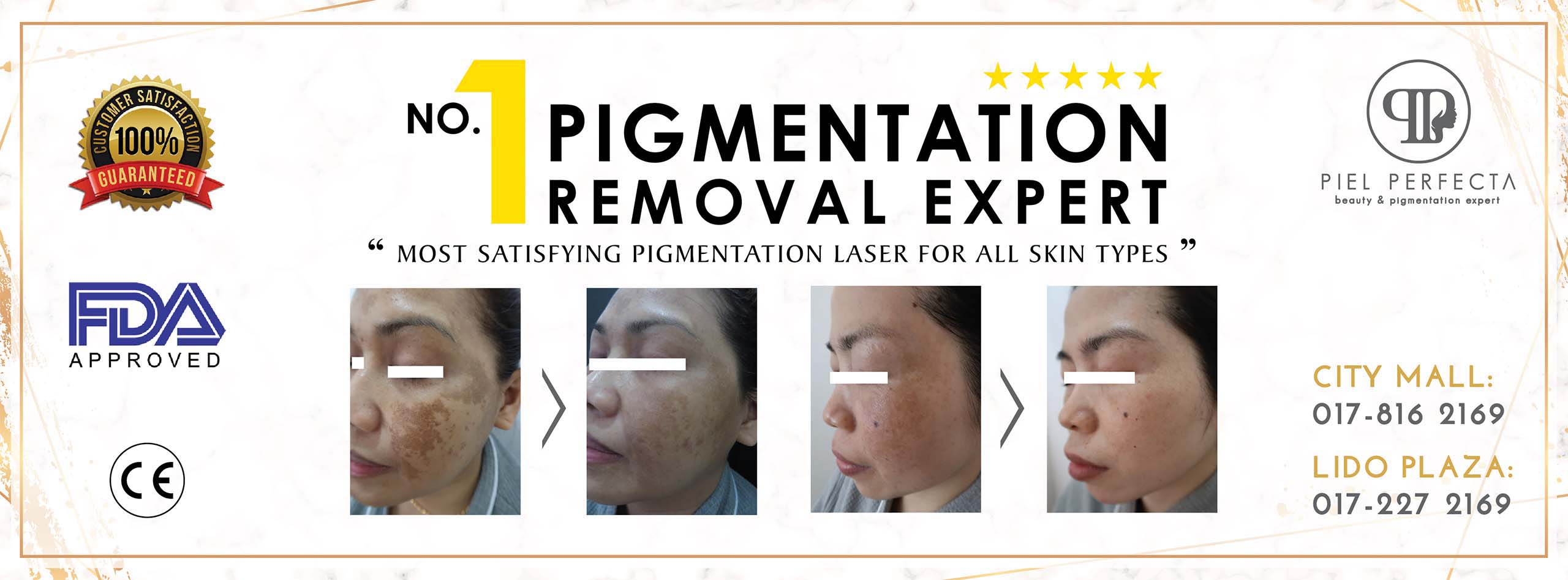 Piel Perfecta Laser Centre City Mall – Rawatan Kulit Profesional & Hasil Sempurna