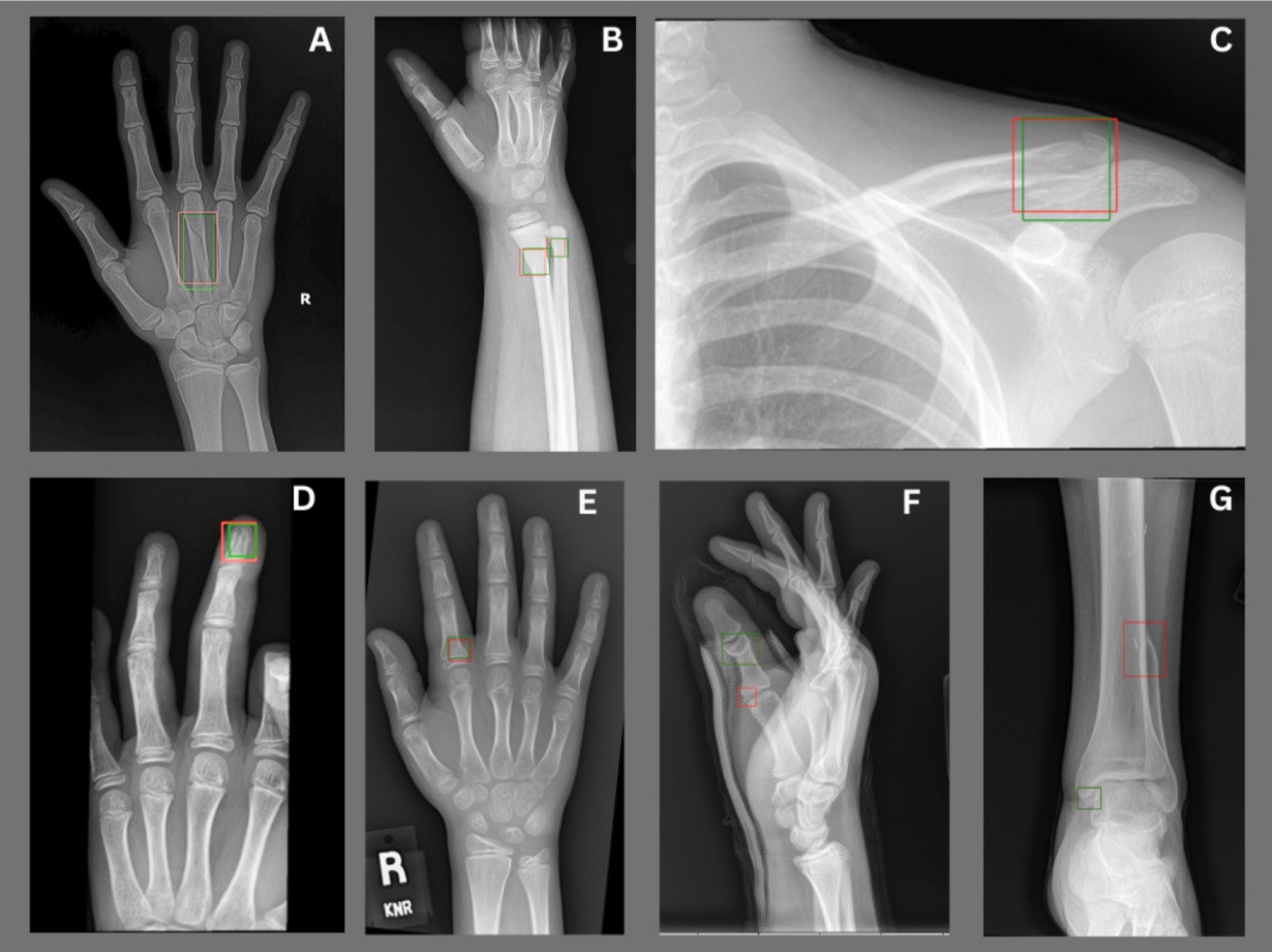 Klinik Az Medici & X-ray - Perkhidmatan Kesihatan Profesional, Ujian X-ray Berkualiti