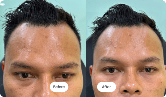 Klinik Kecantikan & Transplant Rambut Peters Radiant Subang – Rawatan Rambut Semulajadi & Estetika