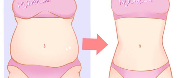 Klinik Penurunan Berat Badan Terbaik di Puchong – Program Cepat & Selamat