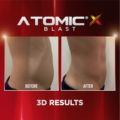 Slim Doc Sutera – Pakaian Sukan Ringan & Bergaya untuk Senaman Efektif