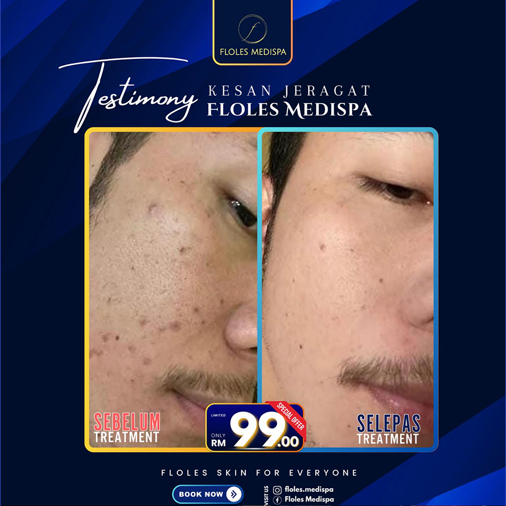 Floles Medispa Kota Bharu, Kelantan – Rawatan Kecantikan & Kesihatan Terbaik