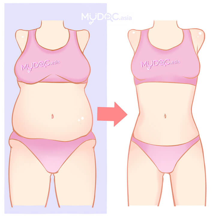 Gambar Klinik Penurunan Berat Badan Terbaik di Kuala Kedah – Program Slimming Efektif & Testimoni Pelanggan